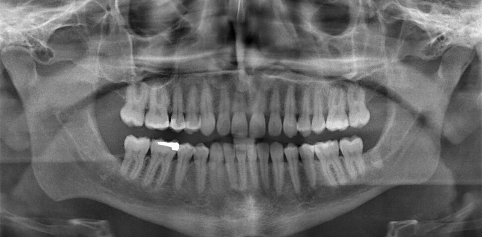 Photo Op: Types Of Dental X-Rays