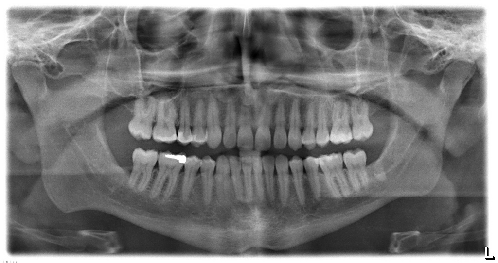 Photo Op: Types Of Dental X-Rays